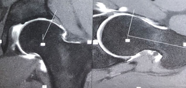 artroscopia
